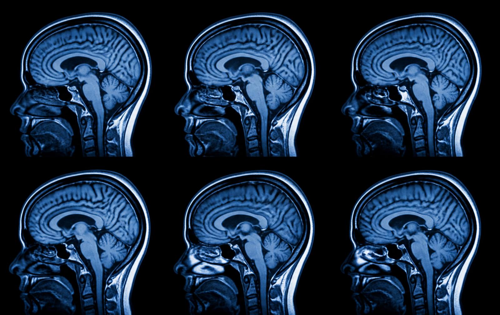 Neurocirurgia Crânio e Coluna